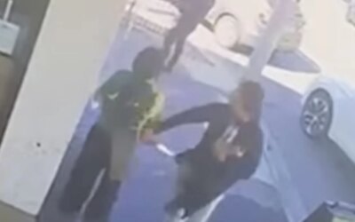 Serveuse blessée au visage : une vidéo qui fait le tour du web